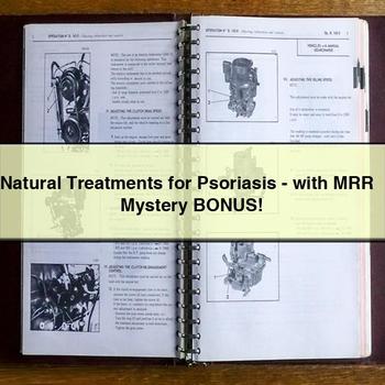 Natural Treatments for Psoriasis-with Mrr + Mystery Bonus PDF Download